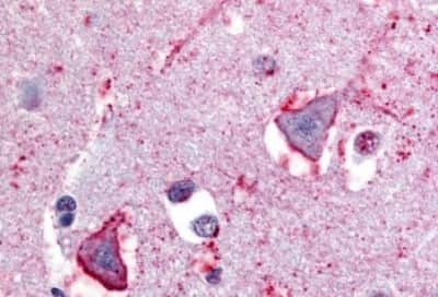 Immunohistochemistry-Paraffin: NPBWR1 Antibody [NBP3-14424] - Immunohistochemistry of formalin-fixed, paraffin-embedded human brain after heat-induced antigen retrieval.